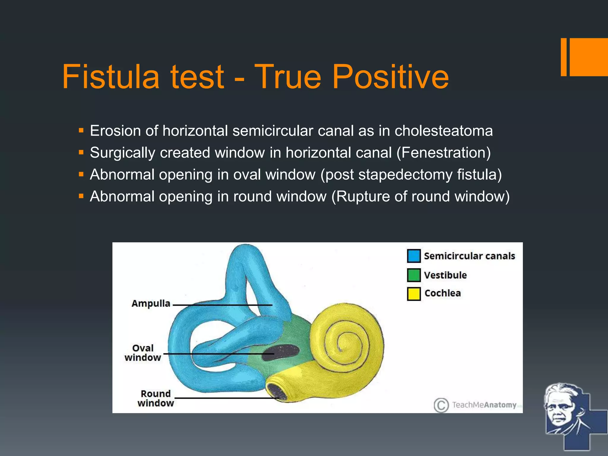 Vestibular Function Test | PPTX | Brain and Nervous System Disorders ...