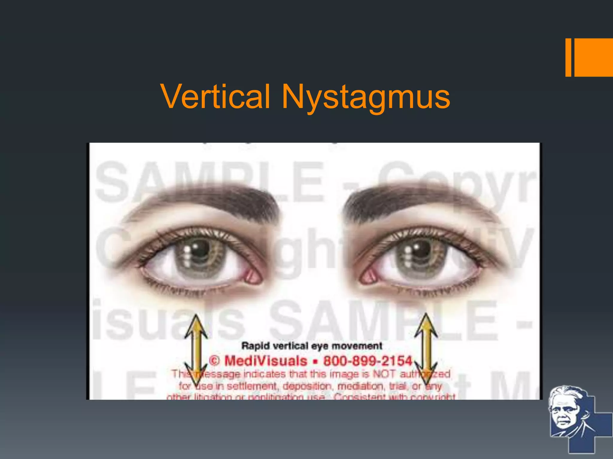 Vestibular Function Test | PPTX