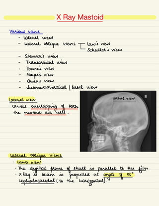 Comprehensive X-Ray Imaging Techniques in ENT and Neck Diagnostics | PDF