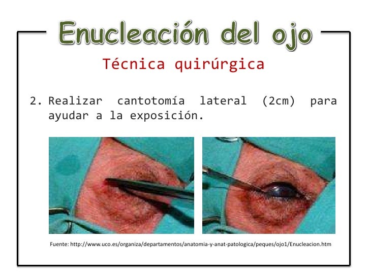 Tecnica debajo de la falda 2