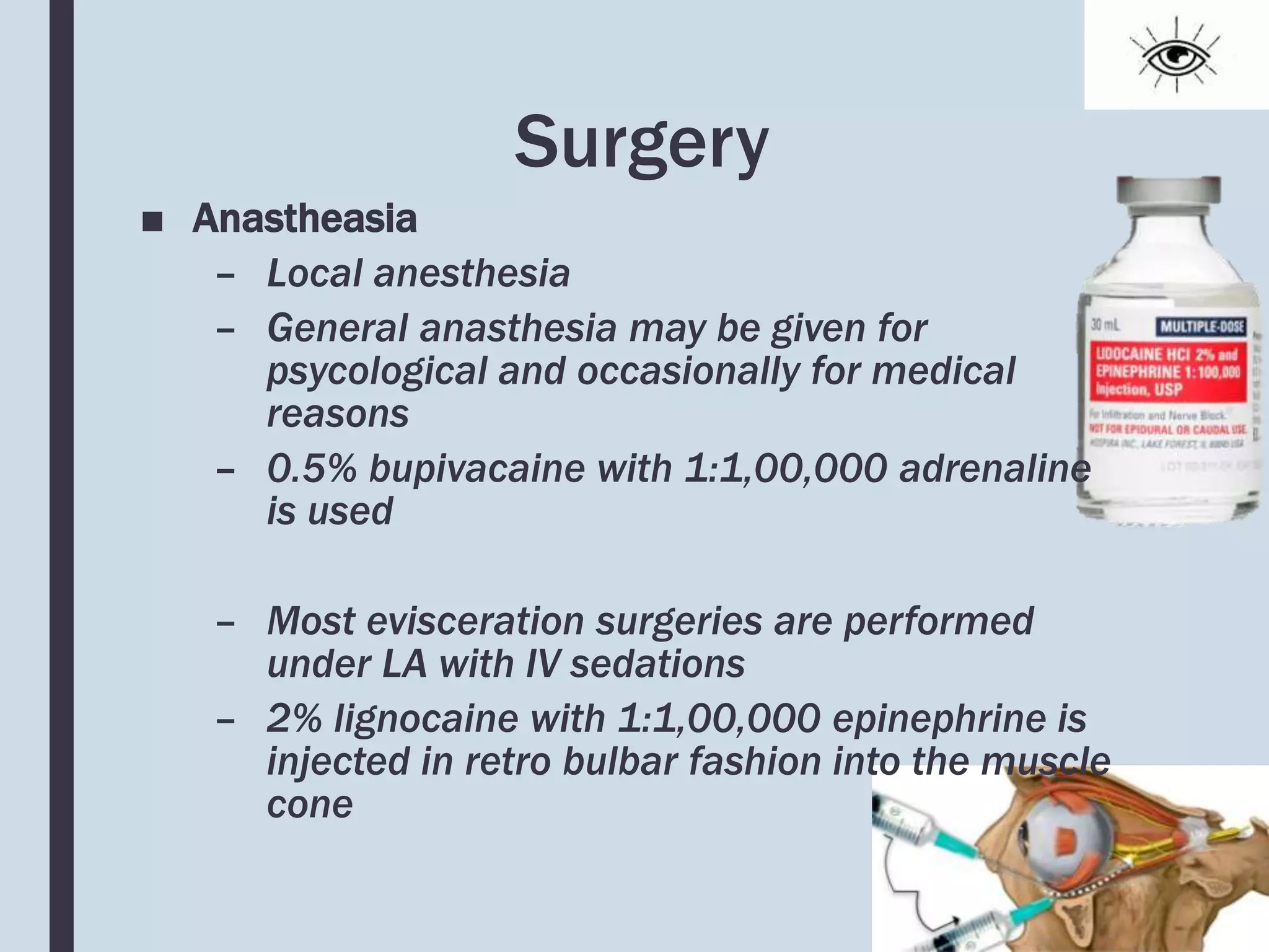 Surgery
■ Anastheasia
– Local anesthesia
– General anasthesia may be given for
psycological and occasionally for medical
reasons
– 0.5% bupivacaine with 1:1,00,000 adrenaline
is used
– Most evisceration surgeries are performed
under LA with IV sedations
– 2% lignocaine with 1:1,00,000 epinephrine is
injected in retro bulbar fashion into the muscle
cone
 