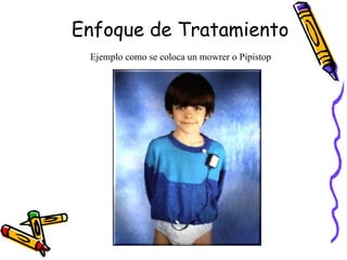 Enfoque de Tratamiento  Ejemplo como se coloca un mowrer o Pipistop   