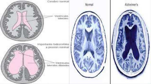 CAMBIOS MOLECULARES
• A nivel molecular, se ha sugerido que el envejecimiento podría estar relacionado con cambios
asociad...