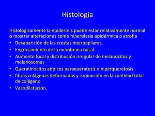 Histologia
Histológicamente la epidermis puede estar relativamente normal
o mostrar alteraciones como hiperplasia epidérmica o atrofia
• Desaparición de las crestas interpapilares
• Engrosamiento de la membrana basal
• Aumento focal y distribución irregular de melanocitos y
melanosomas
• Queratinocitos atípicos paraqueratosis e hiperqueratosis
• fibras colágenas deformadas y isminución en la cantidad total
de colágeno
• Vasodilatación.
 