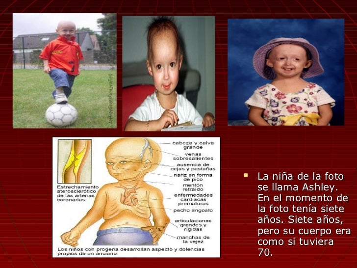 Los tratamientos del alcoholismo furazolidonom