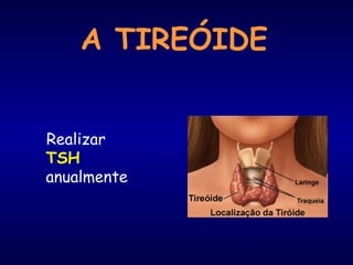 A TIREÓIDE
Realizar
TSH
anualmente
 