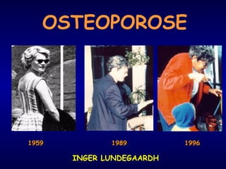 OSTEOPOROSE
19591959 1996199619891989
INGER LUNDEGAARDH
 