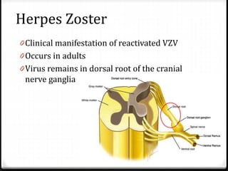 Herpes Zoster
0 Clinical manifestation of reactivated VZV
0 Occurs in adults
0 Virus remains in dorsal root of the cranial
nerve ganglia

 