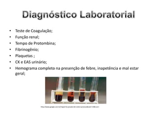 •   Teste de Coagulação;
•   Função renal;
•   Tempo de Protombina;
•   Fibrinogênio;
•   Plaquetas ;
•   CK e EAS urinário;
•   Hemograma completo na presenção de febre, inapetência e mal estar
    geral;




                 http://www.google.com.br/imgres?q=picada+de+cobra+jararaca&start=10&num=
 