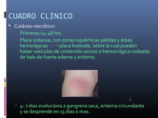 CUADRO CLINICO
 Cutáneo necrótico:
 Primeras 24-48 hrs.
 Placa violacea, con zonas isquémicas pálidas y áreas
hemorágicas placa liveloide, sobre la cual pueden
haber vesículas de contenido seroso o hemorrágico rodeado
de halo de fuerte edema y eritema.
 4- 7 días evoluciona a gangrena seca, eritema circundante
y se desprende en 15 días o mas.
 