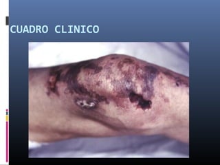 CUADRO CLINICO
 