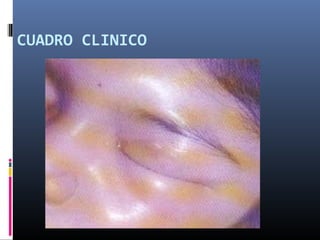 CUADRO CLINICO
 