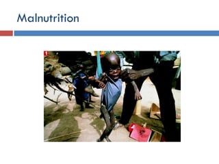 Environmental Issues and Sustainability