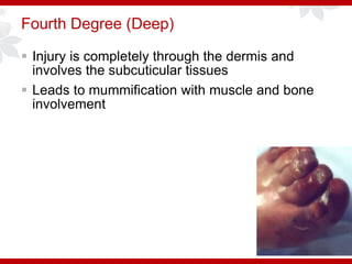 Deep Injuries Ohio ACEP Board Review: Environmental Emergencies I | PPTX