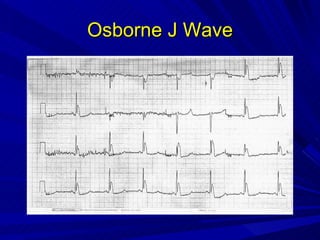 Osborne J Wave 