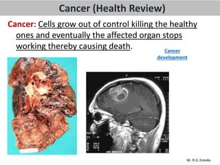 Mr. R.G. Estrella
Cancer (Health Review)
Cancer: Cells grow out of control killing the healthy
ones and eventually the affected organ stops
working thereby causing death. Cancer
development
 