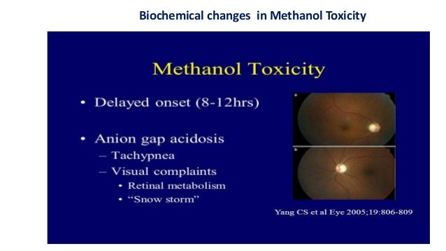 Methanol Vs Ethanol >> Environmental pollutants and their clinical significance Methanol Vs Ethanol >> Environmental pollutants and their clinical significance