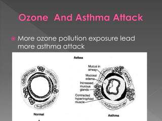  More ozone pollution exposure lead 
more asthma attack 
 