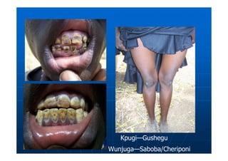 Kpugi—Gushegu
Wunjuga—Saboba/Cheriponi
 