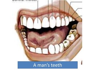 A man’s teeth
 