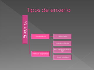 Enxertos
Xenoenxertos Osso bovino
Materiais aloplásticos
Hidroxiapatita HA
Beta fosfato tricálcio b-
TCP
Vidros bioativos
 