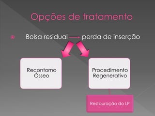  Bolsa residual perda de inserção
Recontorno
Ósseo
Procedimento
Regenerativo
Restauração do LP
 