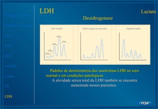 Fosfatase Ácida Fosfatase Alcalina TGO TGP GGT Amilase Lipase CK LDH Padrões de densitometria das isoenzimas LDH no soro normal e em condições patológicas   A atividade sérica total da LDH também se encontra aumentada nesses pacientes.  LDH  Lactato Desidrogenase 