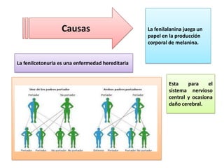Causas

La fenilalanina juega un
papel en la producción
corporal de melanina.

La fenilcetonuria es una enfermedad hereditaria

Esta
para
el
sistema nervioso
central y ocasiona
daño cerebral.

 