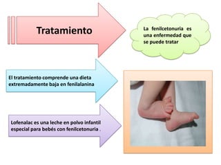 Tratamiento

El tratamiento comprende una dieta
extremadamente baja en fenilalanina

Lofenalac es una leche en polvo infantil
especial para bebés con fenilcetonuria .

La fenilcetonuria es
una enfermedad que
se puede tratar

 