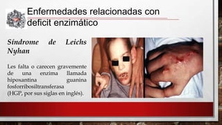 Enfermedades relacionadas con
deficit enzimático
Síndrome
Nyhan

de

Leichs

Les falta o carecen gravemente
de
una
enzima
llamada
hipoxantina
guanina
fosforribosiltransferasa
(HGP, por sus siglas en inglés).

 