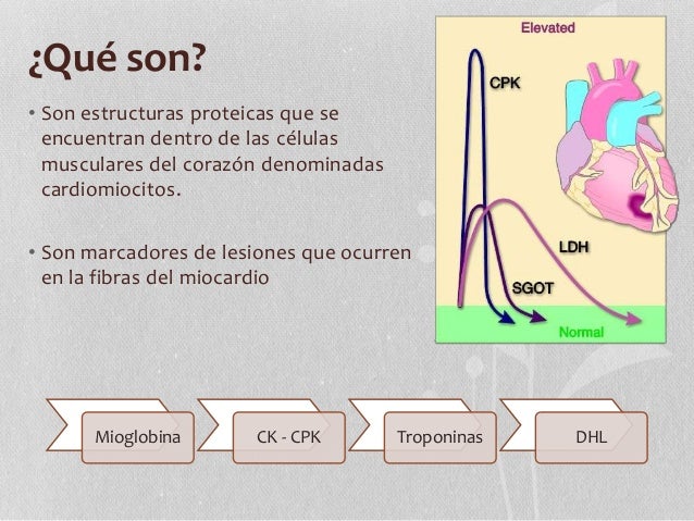 Enzimas Cardiacas