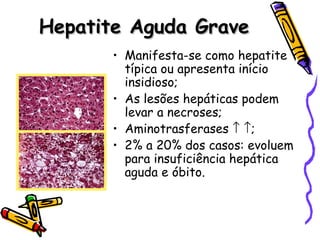 Hepatite Aguda GraveHepatite Aguda Grave
• Manifesta-se como hepatite
típica ou apresenta início
insidioso;
• As lesões hepáticas podem
levar a necroses;
• Aminotrasferases ↑ ↑;
• 2% a 20% dos casos: evoluem
para insuficiência hepática
aguda e óbito.
 