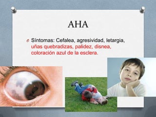 AHA
O Síntomas: Cefalea, agresividad, letargia,

uñas quebradizas, palidez, disnea,
coloración azul de la esclera.

 