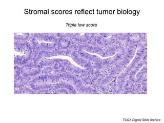 Stromal scores reflect tumor biology
CAF++ score
TCGA Digital Slide Archive
 