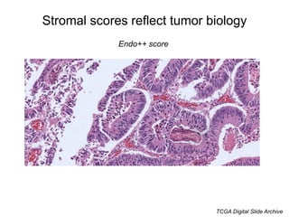 Stromal scores reflect tumor biology
Leuco++ score
TCGA Digital Slide Archive
 