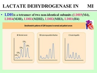 LACTATE DEHYDROGENASE IN MI
 