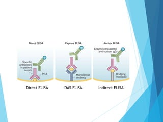 Direct ELISA DAS ELISA Indirect ELISA
 