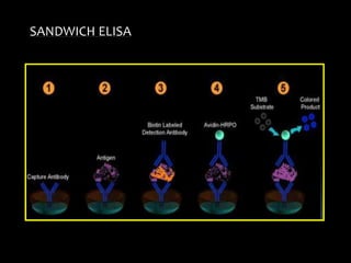 SANDWICH ELISA
 