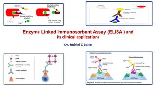 Enzyme Linked Immunosorbent Assay (ELISA ) and
its clinical applications
Dr. Rohini C Sane
 