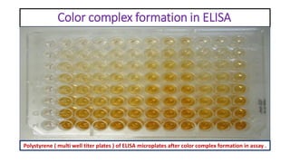 Enzyme linked immunosorbent assay (elisa) and its clinical significance ...