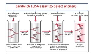 Enzyme linked immunosorbent assay (elisa) and its clinical significance ...