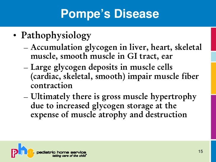 pompe disease causes and symptoms Read on to know more about pompe disease symptoms and treatment follow us: pompe disease treatment causes of weak nails. pompe disease causes and symptoms Read on to know more about pompe disease symptoms and treatment follow us: pompe disease treatment causes of weak nails.
