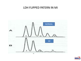 Enzymes & isoenzymes by Dr. Anurag Yadav