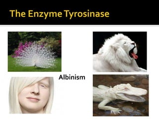 Albinism
 