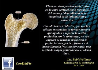 Edema Oseo