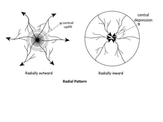 Radially Inward Pattern Mapwork skills.pptx
