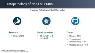Eosinophilic Esophagitis: Criteria of Diagnosis and Management | PPTX