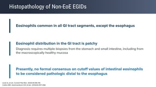 Eosinophilic Esophagitis: Criteria of Diagnosis and Management | PPTX