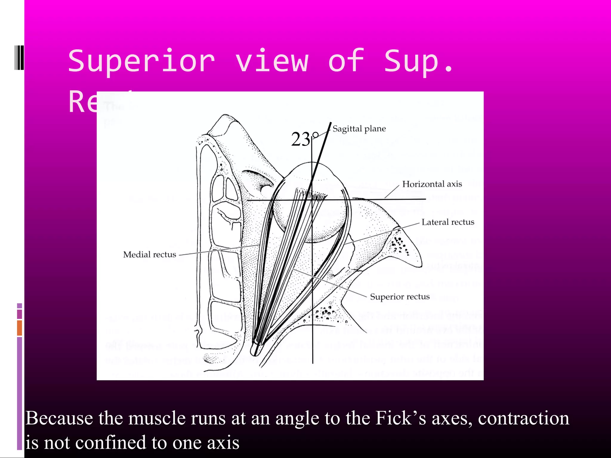 Superior view of Sup.
Rectus
23°
Because the muscle runs at an angle to the Fick’s axes, contraction
is not confined to one axis
 