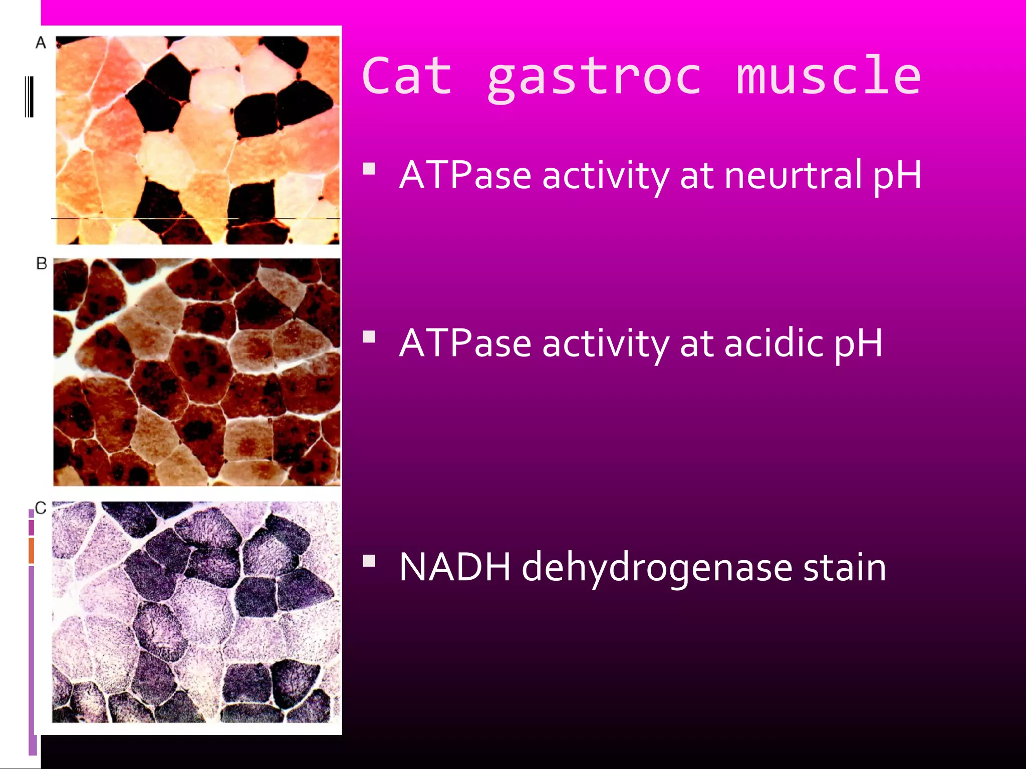 Cat gastroc muscle
 ATPase activity at neurtral pH
 ATPase activity at acidic pH
 NADH dehydrogenase stain
 